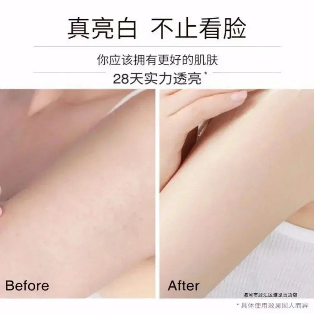 Vaseline Niacinamide Body Lotion 400ml Relieves Dry Dehydrated Skin Exfoliates Nourishing Hydrating Skin Care Brighten Skin Tone - Femlinza